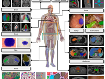 好色tv
倪东教授团队在《Medical Image Analysis》上发表文章